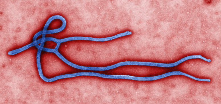 Ebola replicates in Lungs, says research study